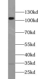 Western Blot: USP15 Antibody - BSA Free [NBP3-45628] - Mouse brain tissue were subjected to SDS PAGE followed by western blot with (USP15 Antibody) at dilution of 1:1000