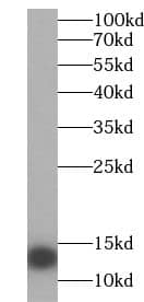 Western Blot Uroguanylin Antibody - BSA Free