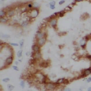 Immunohistochemistry Uroguanylin Antibody - BSA Free
