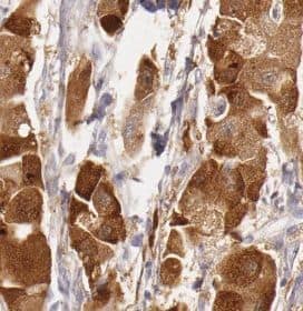 Immunohistochemistry URM1 Antibody - BSA Free