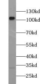 Western Blot: URG4 Antibody - BSA Free [NBP3-45633] - HEK-293 cells were subjected to SDS PAGE followed by western blot with (URG4 antibody) at dilution of 1:400