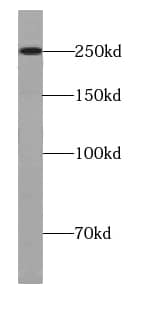 Western Blot: URB1 Antibody - BSA Free [NBP3-45634] - K-562 cells were subjected to SDS PAGE followed by western blot with (URB1 antibody) at dilution of 1:500