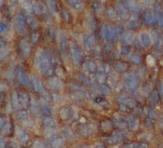 Immunohistochemistry MNF1 Antibody - BSA Free