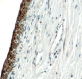 Immunohistochemistry: Uroplakin II Antibody - BSA Free [NBP3-45640] - Immunohistochemistry of paraffin-embedded human bladder using (Uroplakin II antibody) at dilution of 1:100