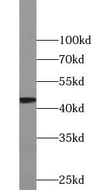 Western Blot: KIST Antibody - BSA Free [NBP3-45646] - Mouse thymus tissue were subjected to SDS PAGE followed by western blot with (KIST antibody) at dilution of 1:500