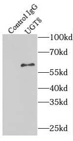 Immunoprecipitation: UGT8 Antibody - BSA Free [NBP3-45647] - IP Result of anti-UGT8 (IP:, 4ug; Detection: 1:1000) with rat brain tissue lysate 4000ug.