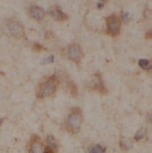 Immunohistochemistry: UGT8 Antibody - BSA Free [NBP3-45647] - Immunohistochemistry of paraffin-embedded human brain using (UGT8 antibody) at dilution of 1:100