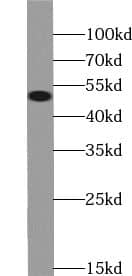 Western Blot: UGT3A2 Antibody - BSA Free [NBP3-45648] - Human testis tissue were subjected to SDS PAGE followed by western blot with (UGT3A2 antibody) at dilution of 1:500