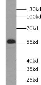 Western Blot: UGCG Antibody - BSA Free [NBP3-45651] - A375 cells were subjected to SDS PAGE followed by western blot with (UGCG antibody) at dilution of 1:1000