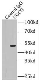 Immunoprecipitation: UGCG Antibody - BSA Free [NBP3-45651] - IP Result of anti-UGCG (IP:, 4ug; Detection: 1:500) with A375 cells lysate 3200ug.