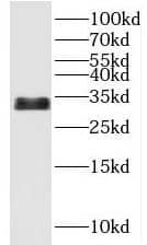 Western Blot: UCMA Antibody - BSA Free [NBP3-45654] - Transfected HEK-293 cells were subjected to SDS PAGE followed by western blot with (UCMA Antibody) at dilution of 1:1000