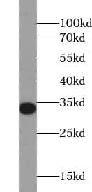 Western Blot: UCK Antibody - BSA Free [NBP3-45655] - MCF7 cells were subjected to SDS PAGE followed by western blot with (UCK antibody) at dilution of 1:1000