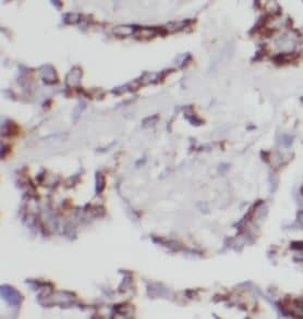 Immunohistochemistry UBXD5 Antibody - BSA Free