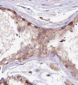Immunohistochemistry: UBN2 Antibody - BSA Free [NBP3-45660] - Immunohistochemical of paraffin-embedded human testis using (UBN2 antibody) at dilution of 1:50
