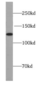 Western Blot UBN1 Antibody - BSA Free