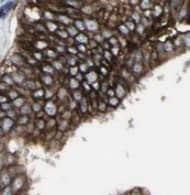 Immunohistochemistry UBN1 Antibody - BSA Free