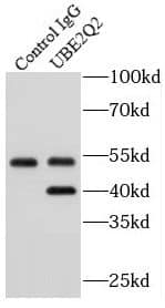 Immunoprecipitation: UBE2Q2 Antibody - BSA Free [NBP3-45664] - IP result of anti-UBE2Q2(IP:, 4ug; Detection: 1:300) with HEK-293T cells lysate 1320 ug