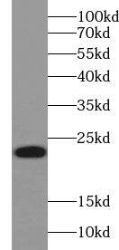 Western Blot UbcH2/UBE2H Antibody - BSA Free