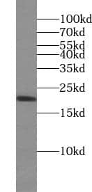 Western Blot: UBE2G1 Antibody - BSA Free [NBP3-45667] - HeLa cells were subjected to SDS PAGE followed by western blot with (UBE2G1 antibody) at dilution of 1:100