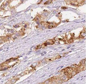 Immunohistochemistry UbcH5c/UBE2D3 Antibody - BSA Free
