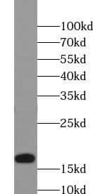 Western Blot: UbcH5c/UBE2D3 Antibody - BSA Free [NBP3-45668] - Human brain tissue were subjected to SDS PAGE followed by western blot with (UbcH5c/UBE2D3 antibody) at dilution of 1:500