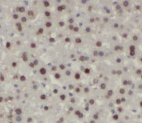 Immunohistochemistry: Ubiquitin C Antibody - BSA Free [NBP3-45669] - Immunohistochemistry of paraffin-embedded human liver using ( Ubiquitin C Antibody) at dilution of 1:100
