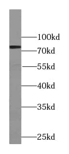 Western Blot: TYW1B Antibody - BSA Free [NBP3-45674] - Mouse liver tissue were subjected to SDS PAGE followed by western blot with (TYW1B antibody) at dilution of 1:500