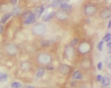 Immunohistochemistry: TYW1B Antibody - BSA Free [NBP3-45674] - Immunohistochemistry of paraffin-embedded human ovary using (TYW1B antibody) at dilution of 1:50