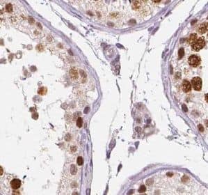 Immunohistochemistry TRXR3 Antibody - BSA Free