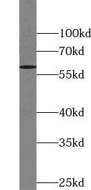 Western Blot TULP3 Antibody - BSA Free