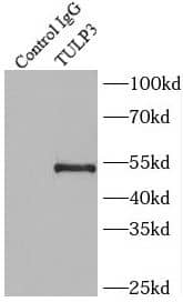Immunoprecipitation: TULP3 Antibody - BSA Free [NBP3-45680] - IP Result of anti-TULP3 (IP:, 4ug; Detection: 1:800) with SH-SY5Y cells lysate 1600ug.