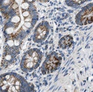 Immunohistochemistry: GCP4 Antibody - BSA Free [NBP3-45684] - Immunohistochemistry of paraffin-embedded human placenta using (GCP4 antibody) at dilution of 1:100