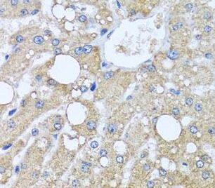 Immunohistochemistry TUBGCP3 Antibody - BSA Free