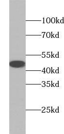 Western Blot: TTLL10 Antibody - BSA Free [NBP3-45686] - Mouse testis tissue were subjected to SDS PAGE followed by western blot with (TTLL10 Antibody) at dilution of 1:1000