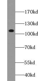 Western Blot: TTI1 Antibody - BSA Free [NBP3-45687] - HeLa cells were subjected to SDS PAGE followed by western blot with (TTI1 Antibody) at dilution of 1:1000