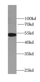 Western Blot: TTC7B Antibody - BSA Free [NBP3-45688] - Mouse liver tissue were subjected to SDS PAGE followed by western blot with (TTC7B Antibody) at dilution of 1:600