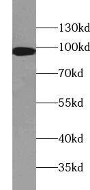 Western Blot: TTC7A Antibody - BSA Free [NBP3-45689] - K-562 cells were subjected to SDS PAGE followed by western blot with (TTC7A Antibody) at dilution of 1:300