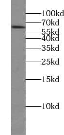 Western Blot: TTC39B Antibody - BSA Free [NBP3-45690] - Mouse testis tissue were subjected to SDS PAGE followed by western blot with (TTC39B antibody) at dilution of 1:800
