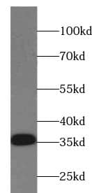 Western Blot: EMC2 Antibody - BSA Free [NBP3-45694] - Jurkat cells were subjected to SDS PAGE followed by western blot with (EMC2 Antibody) at dilution of 1:600