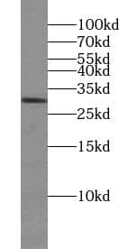 Western Blot: TTC32 Antibody - BSA Free [NBP3-45695] - Mouse testis tissue were subjected to SDS PAGE followed by western blot with (TTC32 Antibody) at dilution of 1:300
