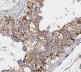Immunohistochemistry TTC31 Antibody - BSA Free