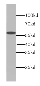 Western Blot TTC31 Antibody - BSA Free