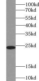 Western Blot: TSR2 Antibody - BSA Free [NBP3-45699] - HeLa cells were subjected to SDS PAGE followed by western blot with (TSR2 antibody) at dilution of 1:400