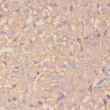 Immunohistochemistry: TSR2 Antibody - BSA Free [NBP3-45699] - Immunohistochemistry of paraffin-embedded human liver using (TSR2 antibody) at dilution of 1:50