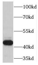 Western Blot TSPYL4 Antibody - BSA Free