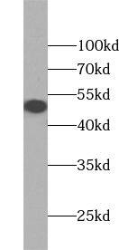 Western Blot: TSPYL1 Antibody - BSA Free [NBP3-45701] - Mouse lung tissue were subjected to SDS PAGE followed by western blot with (TSPYL1 antibody) at dilution of 1:500