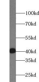 Western Blot TSPY3 Antibody - BSA Free