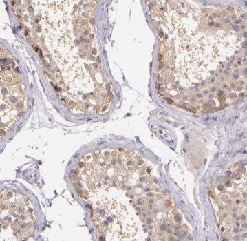 Immunohistochemistry TSPY3 Antibody - BSA Free