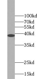 Western Blot: Tetraspanin-5 Antibody - BSA Free [NBP3-45704] - Human brain tissue were subjected to SDS PAGE followed by western blot with (Tetraspanin-5 antibody) at dilution of 1:300