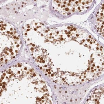 Immunohistochemistry: TSGA13 Antibody - BSA Free [NBP3-45711] - Immunohistochemistry of paraffin-embedded human testis tissue slide using (TSGA13 Antibody) at dilution of 1:50